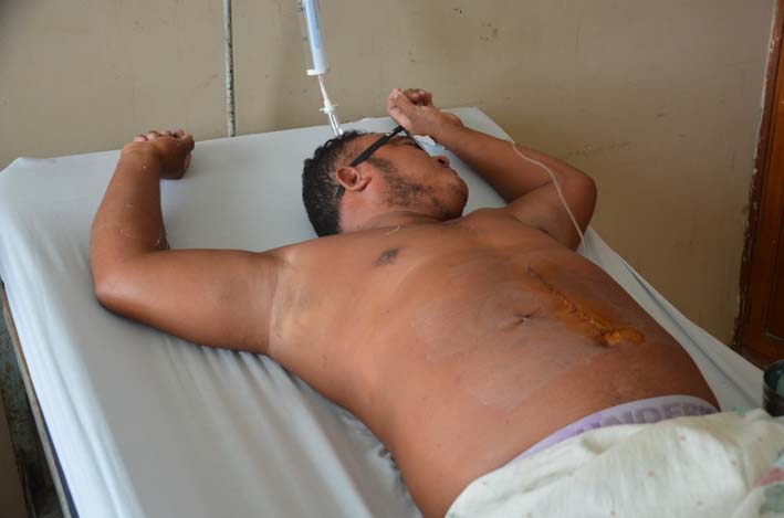 Nicolás Alberto Badillo Frías, quien se recupera de la herida en el hospital San Cristóbal de Ciénaga.