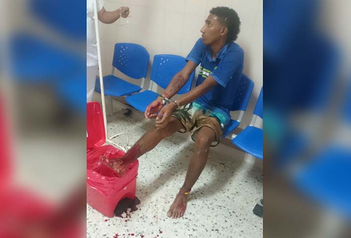 El sujeto se encuentra en el Hospital Nuestra Señora de Los Remedios de Riohacha, en recuperación y custodiado por la Policía Nacional.