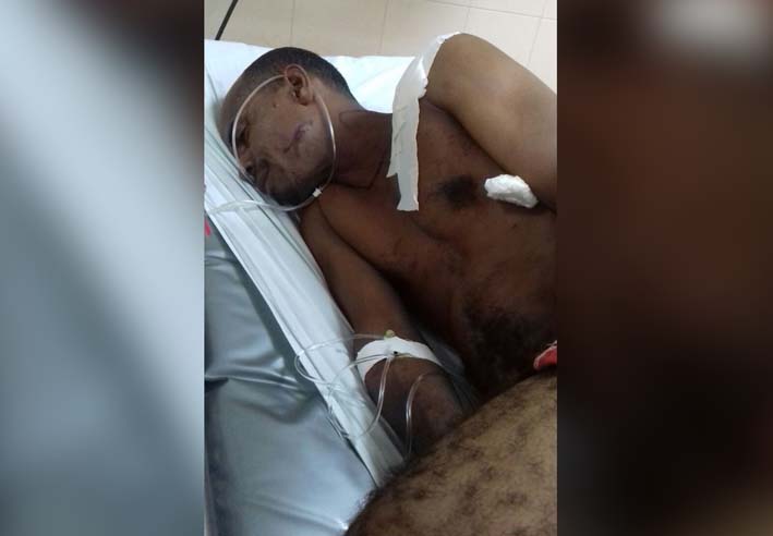 El hombre herido por su compañera sentimental permanece en delicado estado de salud en el Hospital Rosario Pumarejo de López.