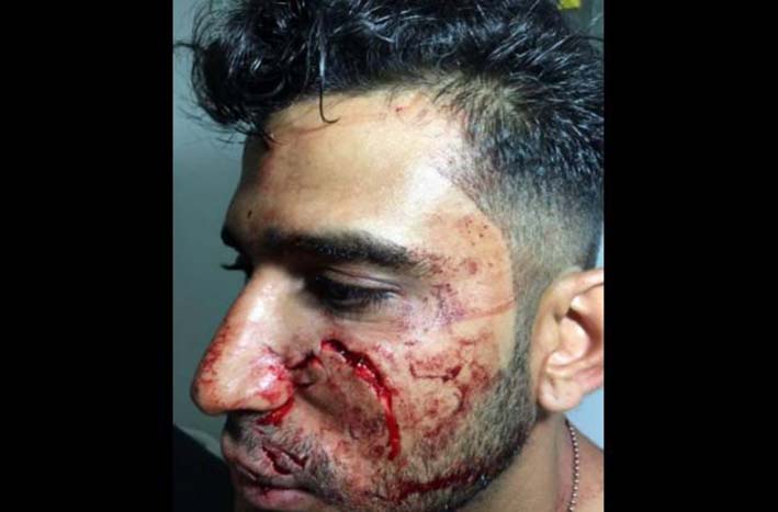 José David Ibarra Sossa terminó con 60 puntos de sutura tras ser agredido.