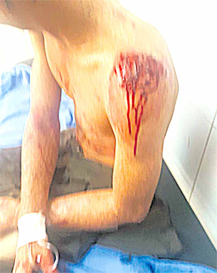 El agredido fue dentificado como Edwin Rafael Manga, de 35 años de edad