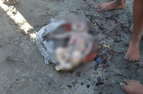 El feto completamente formado fue hallado en sectores de la playa en Ciénaga hasta donde llegaron las autoridades para verificar la situación.