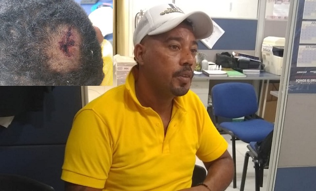 Manuel Meléndez Cera, obrero agredido salvajemente por varios policías en Ciénaga