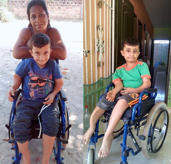 Miguel Ángel tiene 9 años y desde los tres meses de vida le diagnosticaron la osteogénesis imperfecta tipo III. Foto sumistrada por familiares.