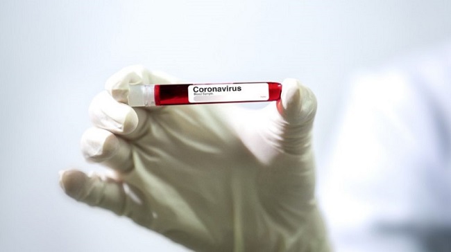 La Secretaría de Salud Municipal, aseguró este martes que a la fecha no se registran casos confirmados de coronavirus en Valledupar. 