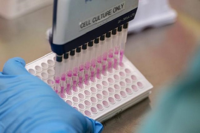 En Colombia hay 33 laboratorios de salud pública habilitados para el procesamiento de estas pruebas.