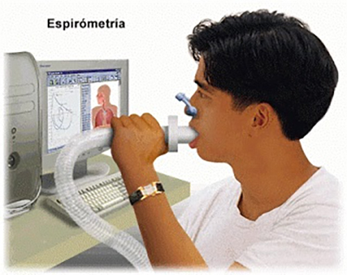 La Espirometría sirve para identificar alguna enfermedad pulmonar o torácica, por ello, los especialistas en Neumonología y Cirugía Torácica, son los encargados de realizar este estudio.