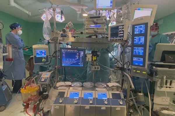 Una máquina de circulación extracorpórea, que permite las cirugías de corazón abierto. Fotografía de archivo tomada de EFE Salud