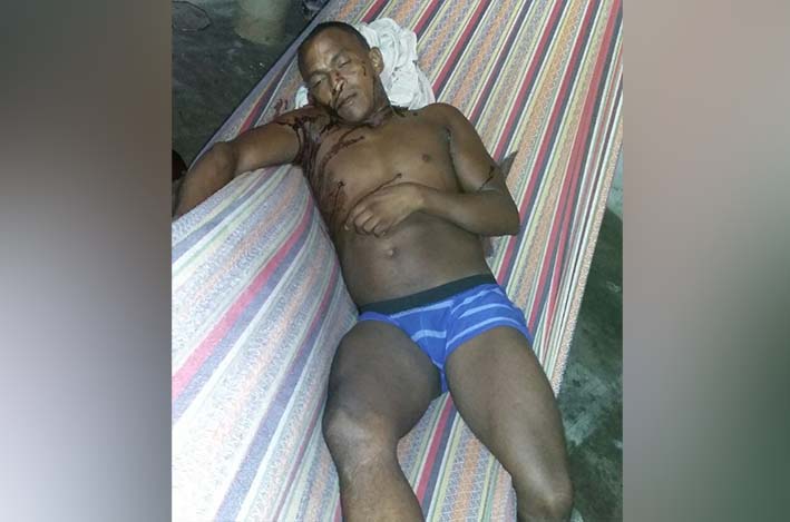 La víctima, Julio Alberto Mendoza Corrales, fue asesinada en una hamaca.