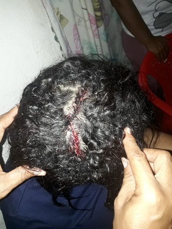 Una de las lesiones fue en la cabeza.