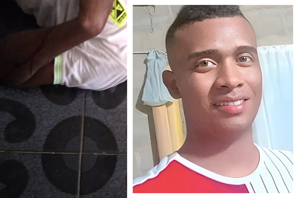 Yosne Cervantes fue acribillado a bala en área rural del corregimiento de Guacamayal.