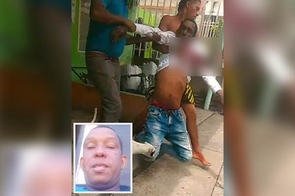 Luis Carlos Charris Díaz fue atacada tiros por desconocidos el pasado 5 de julio en la calle 43 con carrera 12, sur de Santa Marta.