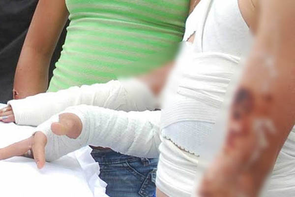 Otras 48 emergencias fueron por siniestros en motos, que dejaron 4 niños afectados, mientras que 31 se debieron a agresiones y cuatro por quemaduras por petardos.