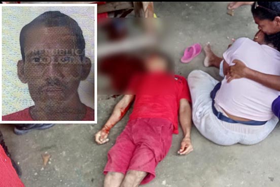 Alfredo Antonio Solano Pacheco, fue atacado a tiros por desconocidos que se movilizaban en una motocicleta. Fotos tomadas del grupo de WhatsApp Zona Activa