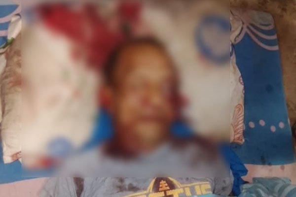 El cuerpo sin vida de Guillermo Bravo Fornaris quedó sobre la cama en la que dormía. Fotos cortesía portal Fusión Stereo Digital