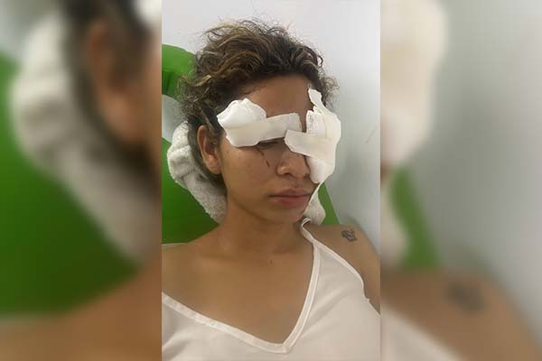 Soraya Villalba, presenta lesiones graves en su cuerpo, principalmente en la casa. Foto suministrada por Alcides Macías