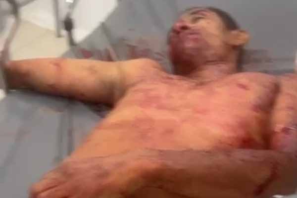 Isaac Medina fue llevado a un centro asistencial a donde fue ingresado sin signos vitales. Fotos cortesía