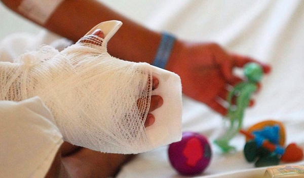 Las autoridades hacen un llamado especial a los magdalenenses a evitar la manipulación de pólvora para prevenir lesiones con estos artefactos.