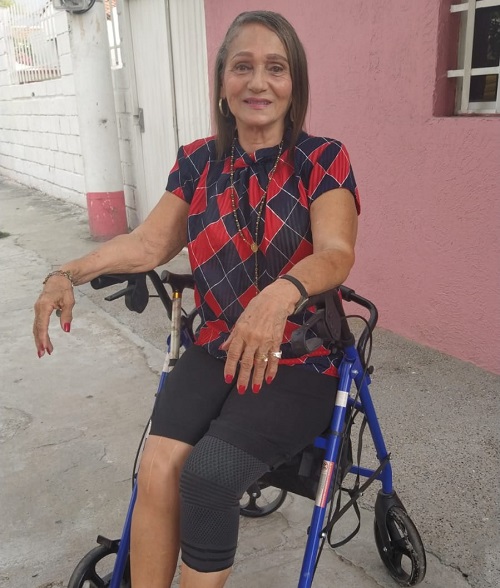 Alicia Martínez, discapacitada por múltiples fracturas en sus piernas a raiz de un sinistro vial.