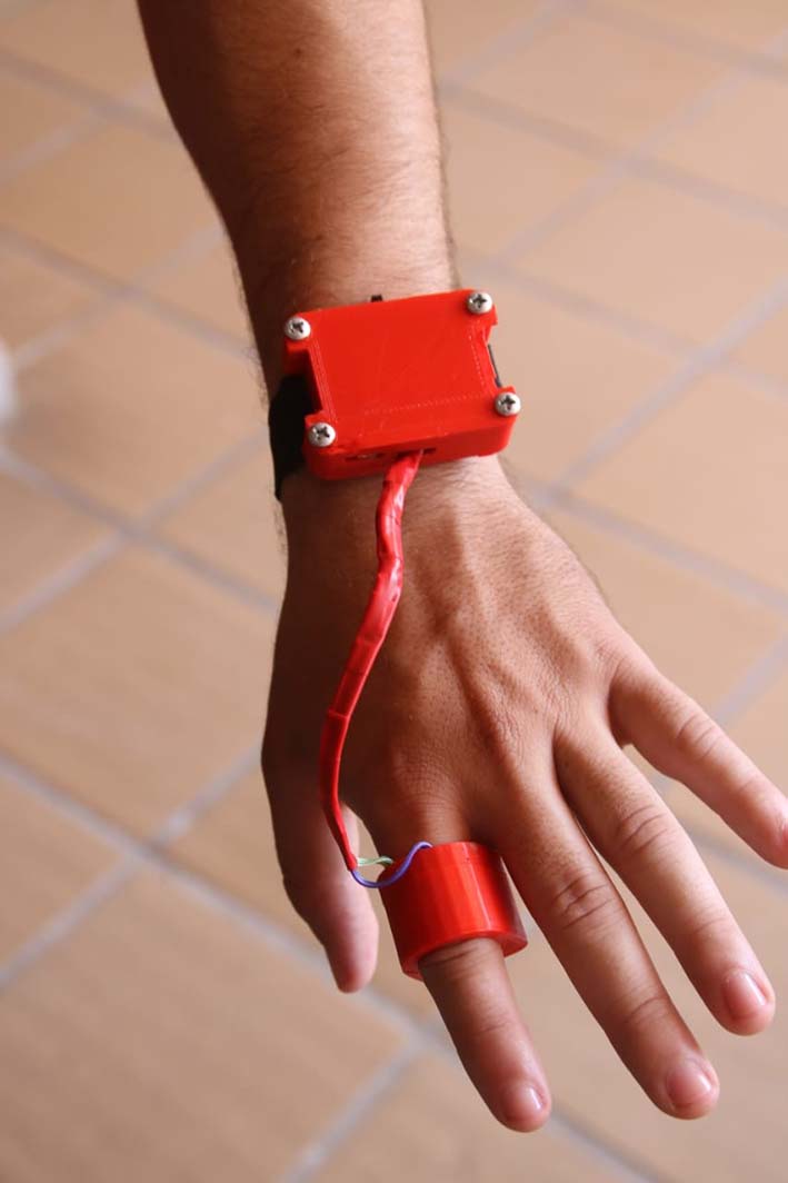 Este es el ‘Sistema biotelemétrico portátil para el monitoreo de variables fisiológicas en pacientes con enfermedades crónicas’.