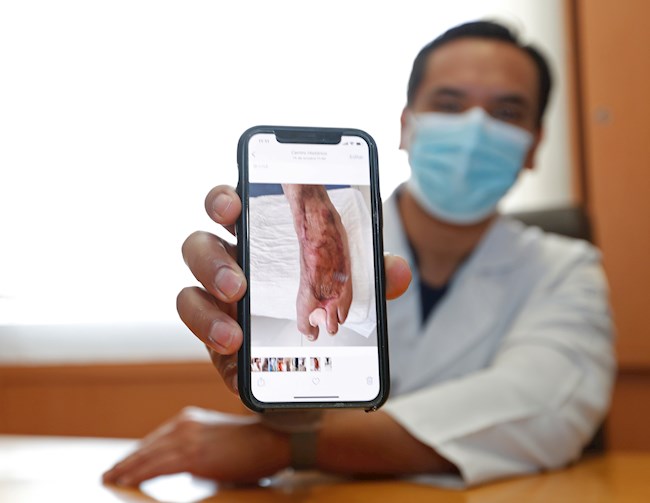 l doctor Roberto Carlos Rebollar muestra efectos de la diabetes durante una entrevista con Efe el 9 de noviembre del 2021 en un hospital de la Ciudad de México (México).